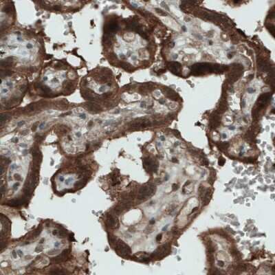 Immunohistochemistry-Paraffin: NAPRT1 Antibody (CL0366) [NBP2-52924]