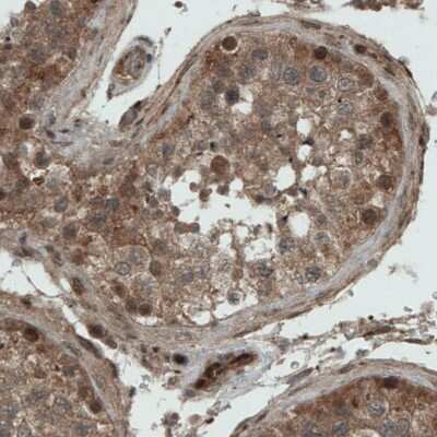 Immunohistochemistry-Paraffin: NAPRT1 Antibody (CL0366) [NBP2-52924]