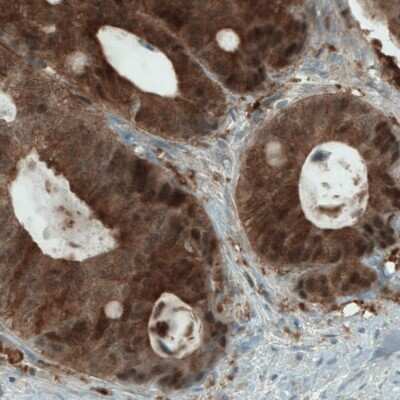 Immunohistochemistry-Paraffin: NAPRT1 Antibody (CL0665) [NBP2-52954]