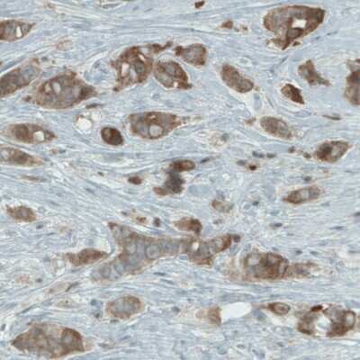 Immunohistochemistry-Paraffin: NAPRT1 Antibody (CL0665) [NBP2-52954]