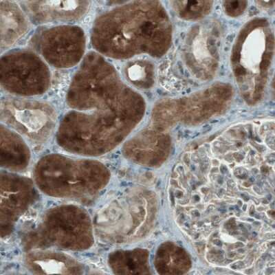 Immunohistochemistry-Paraffin: NAPRT1 Antibody (CL0665) [NBP2-52954]