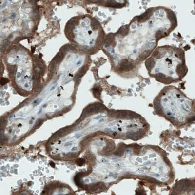 Immunohistochemistry-Paraffin: NAPRT1 Antibody (CL0665) [NBP2-52954]
