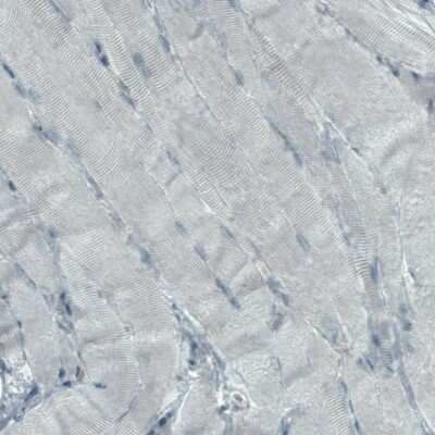 Immunohistochemistry-Paraffin: NAPRT1 Antibody (CL0665) [NBP2-52954]