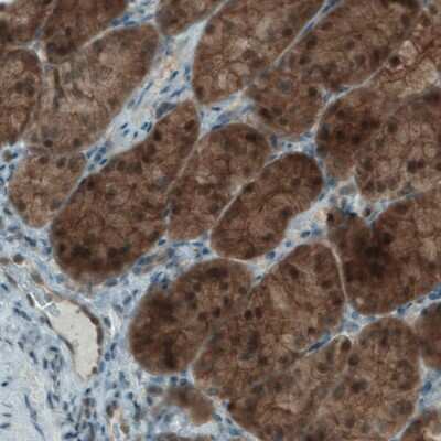 Immunohistochemistry-Paraffin: NAPRT1 Antibody (CL0665) [NBP2-52954]