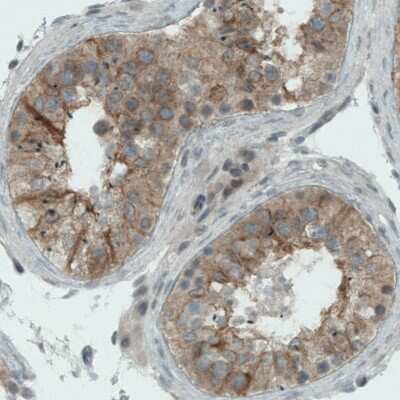 Immunohistochemistry-Paraffin: NAPRT1 Antibody (CL0665) [NBP2-52954]