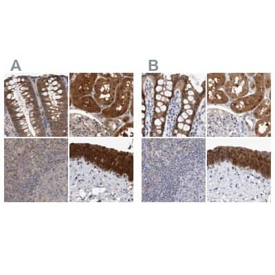 Immunohistochemistry-Paraffin: NAPRT1 Antibody [NBP1-87243]