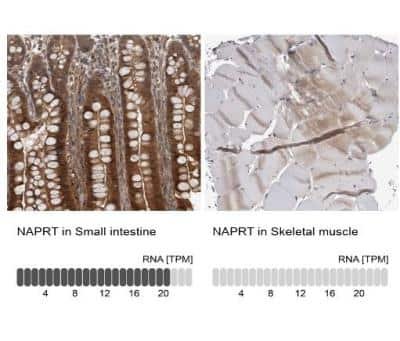 Immunohistochemistry-Paraffin: NAPRT1 Antibody [NBP1-87243]