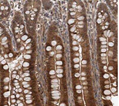 Immunohistochemistry-Paraffin: NAPRT1 Antibody [NBP1-87243]
