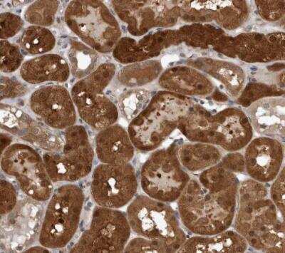 Immunohistochemistry-Paraffin: NAPRT1 Antibody [NBP1-87243]