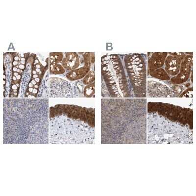 Immunohistochemistry-Paraffin: NAPRT1 Antibody [NBP1-87244]