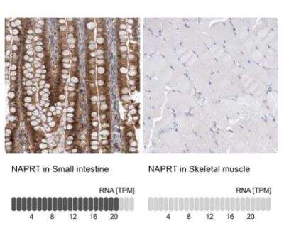 Immunohistochemistry-Paraffin: NAPRT1 Antibody [NBP1-87244]