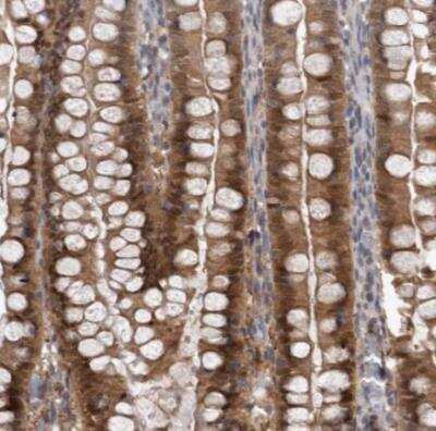 Immunohistochemistry-Paraffin: NAPRT1 Antibody [NBP1-87244]