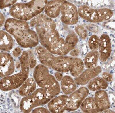 Immunohistochemistry-Paraffin: NAPRT1 Antibody [NBP1-87244]