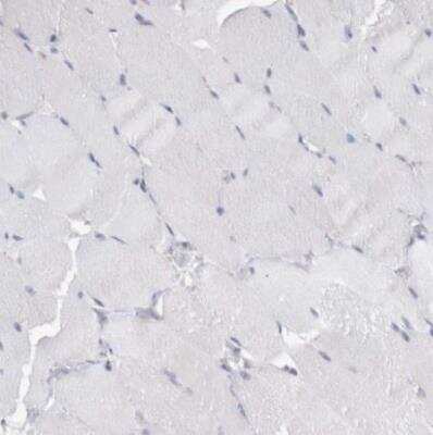 Immunohistochemistry-Paraffin: NAPRT1 Antibody [NBP1-87244]
