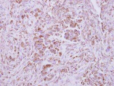 Immunohistochemistry-Paraffin: NAPRT1 Antibody [NBP2-19471]