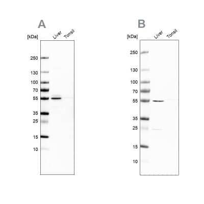 Western Blot: NAPRT1 Antibody [NBP1-87243]