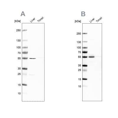 Western Blot: NAPRT1 Antibody [NBP1-87244]