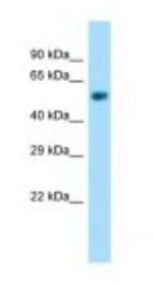 Western Blot: NAPRT1 Antibody [NBP1-98433]