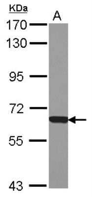 Western Blot: NAPRT1 Antibody [NBP2-19471]