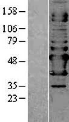 Western Blot: NAPRT1 Overexpression Lysate [NBP2-04424]