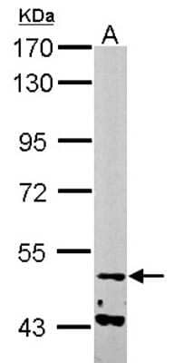 Western Blot: NARF Antibody [NBP2-19474]