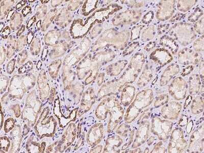Immunohistochemistry: NARFL Antibody [NBP3-06258]