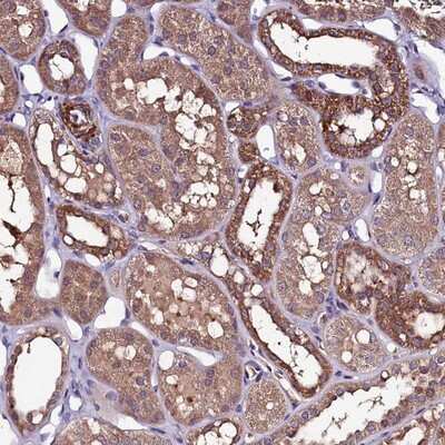 Immunohistochemistry-Paraffin: NARFL Antibody [NBP1-83611]