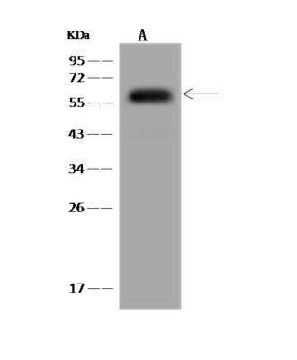 Western Blot: NARFL Antibody [NBP3-06258]