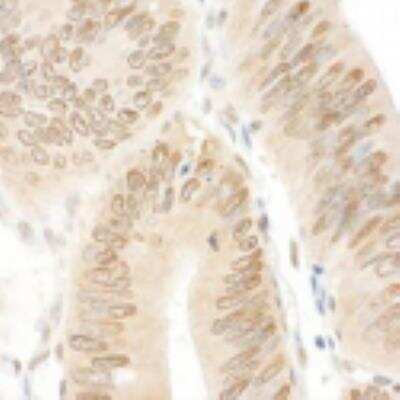 Immunohistochemistry-Paraffin: NARG1 Antibody [NBP1-21387]