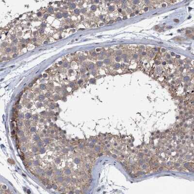 Immunohistochemistry-Paraffin: NARG1 Antibody [NBP1-92165]
