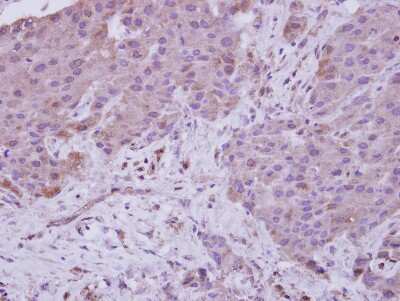 Immunohistochemistry-Paraffin: NARG1 Antibody [NBP2-19478]