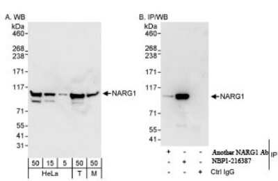 Western Blot: NARG1 Antibody [NBP1-21387]