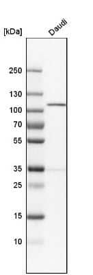 Western Blot: NARG1 Antibody [NBP1-92165]