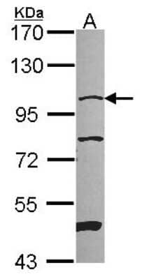 Western Blot: NARG1 Antibody [NBP2-19477]