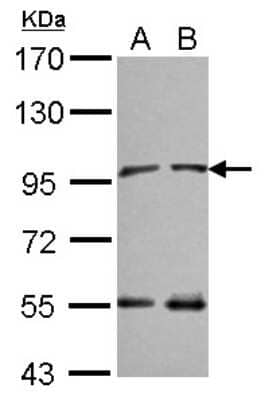 Western Blot: NARG1 Antibody [NBP2-19478]