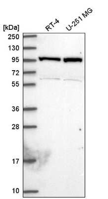 Western Blot: NARG1 Antibody [NBP2-58078]