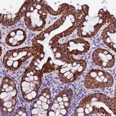 Immunohistochemistry-Paraffin: NARG1L Antibody [NBP1-92166]