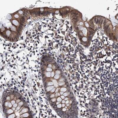 Immunohistochemistry-Paraffin: NARG1L Antibody [NBP1-92167]