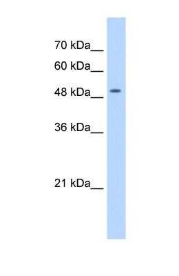 Western Blot: NARG1L Antibody [NBP1-53124]