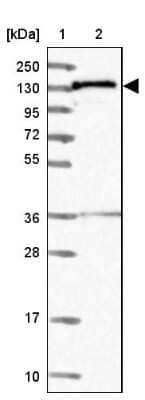 Western Blot: NARG1L Antibody [NBP1-92167]