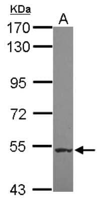 Western Blot: NARG1L Antibody [NBP2-19479]