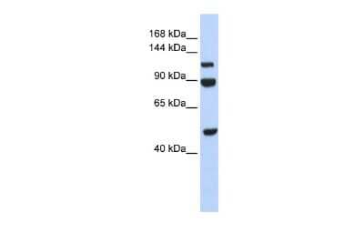 Western Blot: NARG1L Antibody [NBP3-09263]