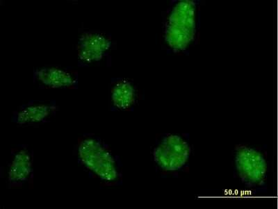 Immunocytochemistry/ Immunofluorescence: NARG2 Antibody [H00079664-B01P]