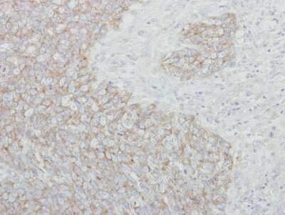 Immunohistochemistry-Paraffin: NARS Antibody [NBP1-31896]