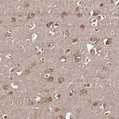 Immunohistochemistry-Paraffin: NARS Antibody [NBP2-13640]
