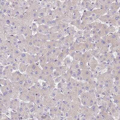 Immunohistochemistry-Paraffin: NARS Antibody [NBP2-13640]