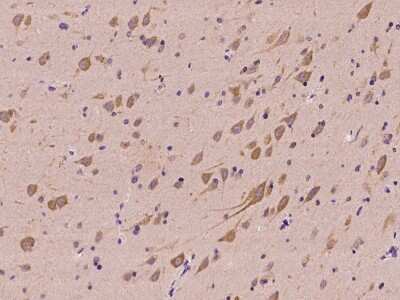 Immunohistochemistry-Paraffin: NARS Antibody [NBP2-98529]