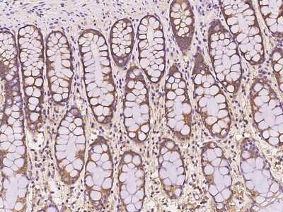 Immunohistochemistry-Paraffin: NARS Antibody [NBP2-98529]