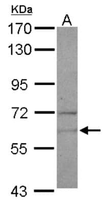 Western Blot: NARS Antibody [NBP1-31896]