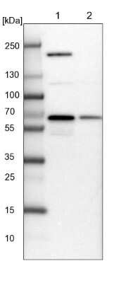 Western Blot: NARS Antibody [NBP2-13640]